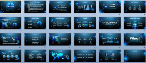 تم پاورپوینت بیماری ریوی